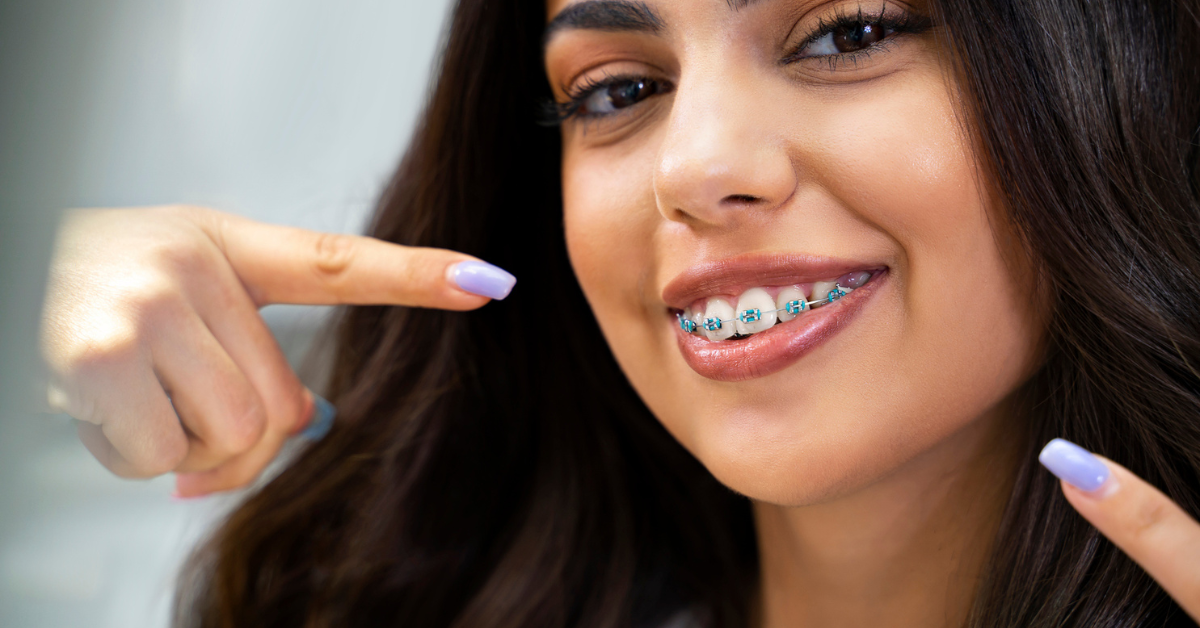 A woman with braces smiles and points to her teeth, showcasing her affordable braces orthodontic treatment.