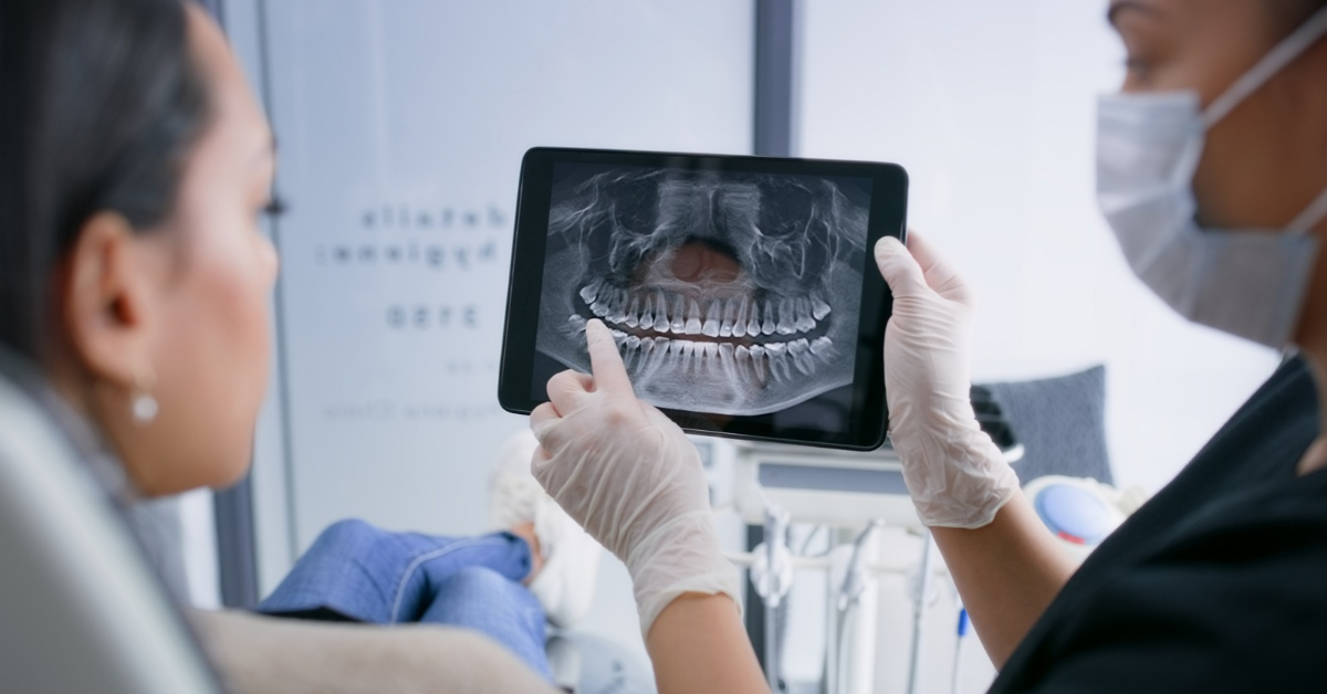 Dental X-Rays for Braces